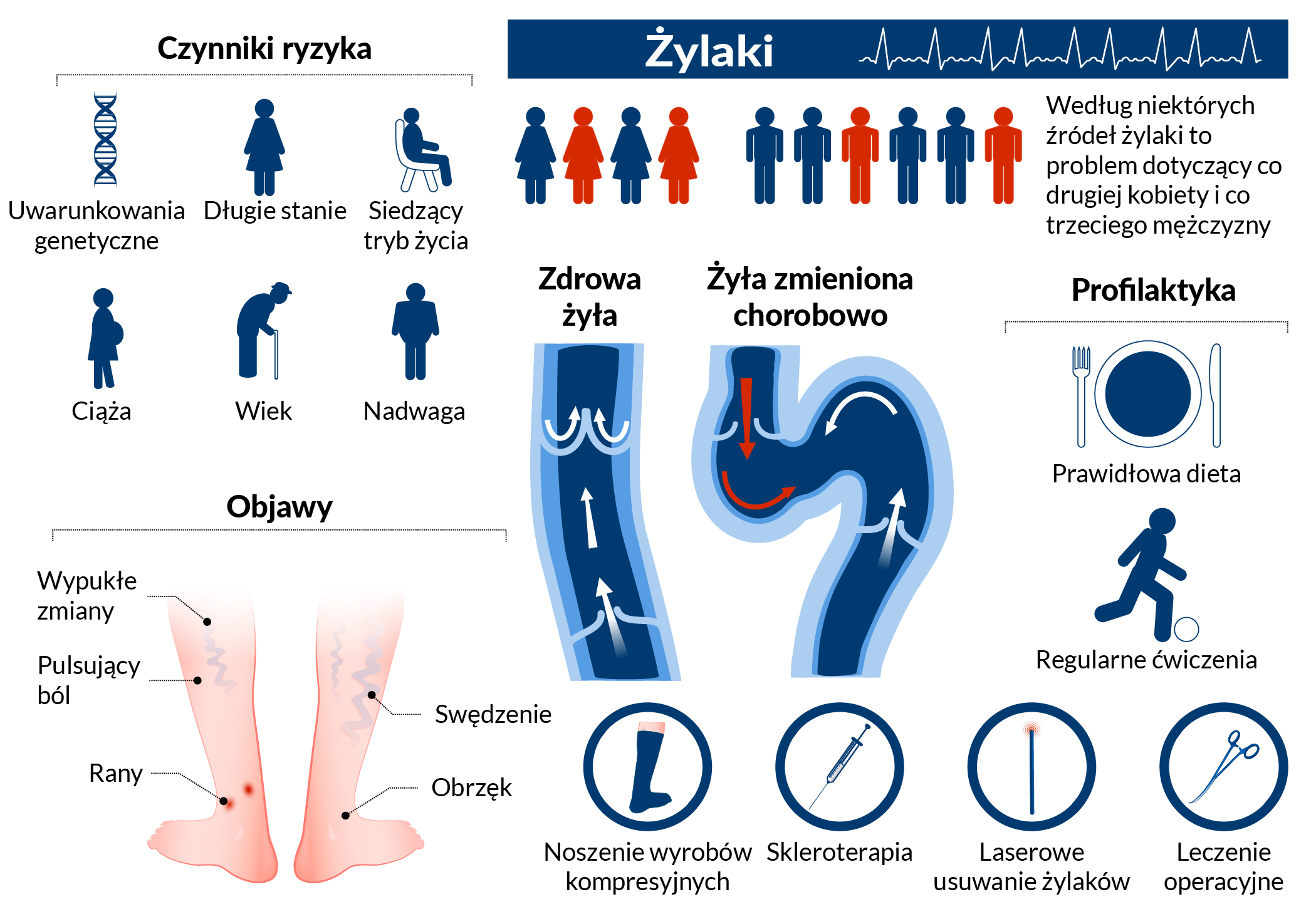 Widoczne żyły na nogach – wskazanie do konsultacji | Ars Estetica