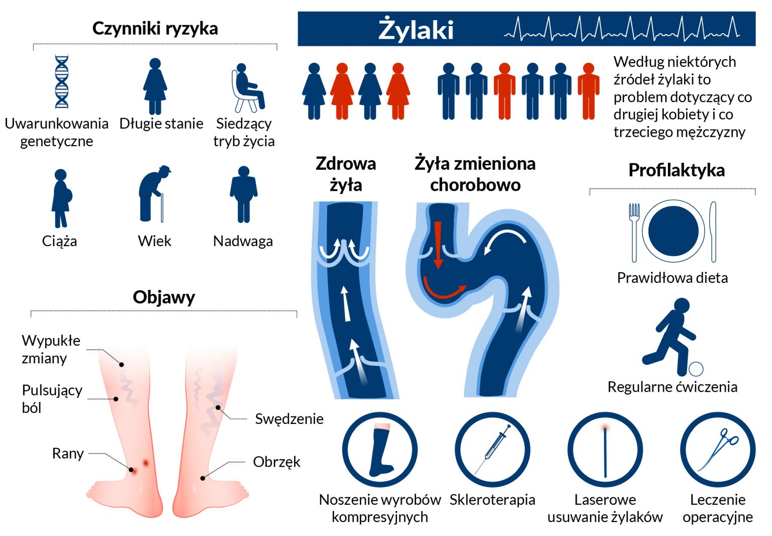 Hybrydowe Leczenie żylaków Ars Estetica 5578